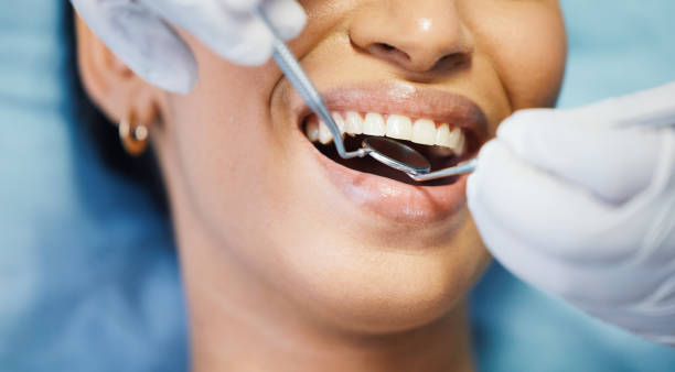 Best Cracked Tooth Emergency Dentist  in Old Jamestown, MO